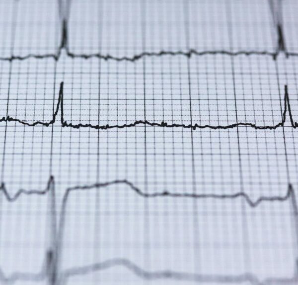 vortex pulse business orbit